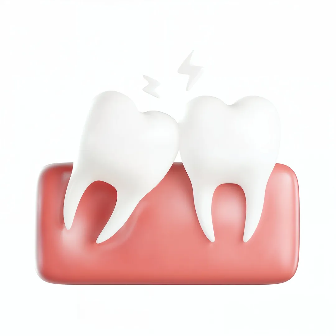 Tooth mobility 